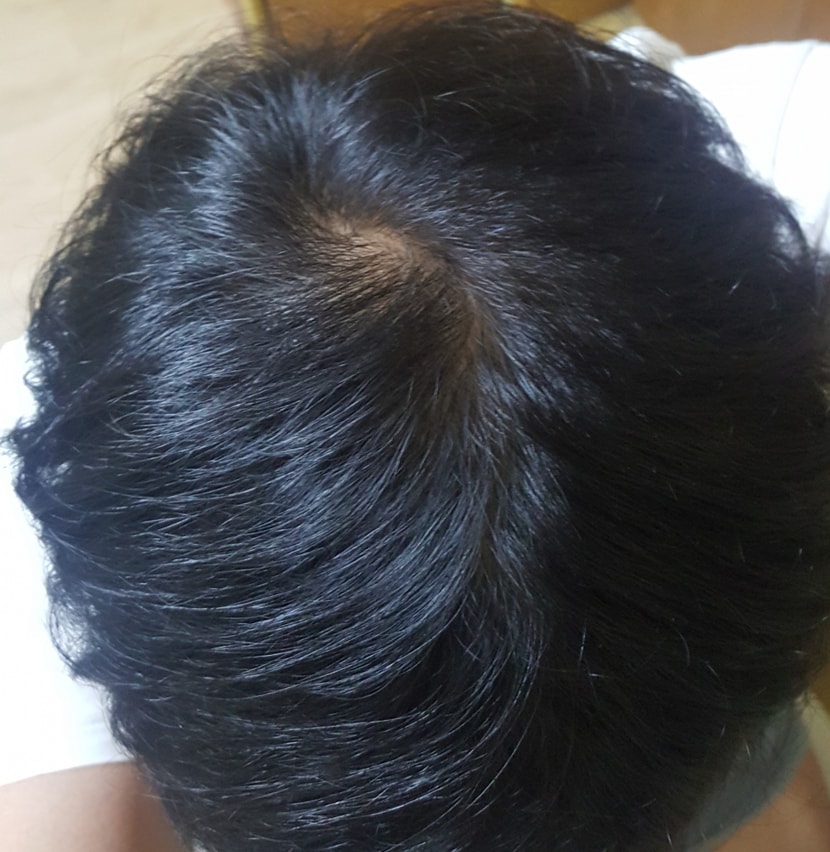 132일차 전체