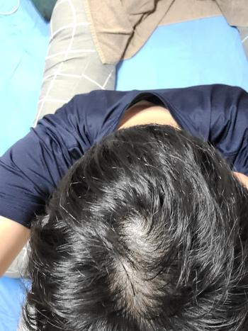 복용 한달차입니다. 쉐딩 왔는지 엄청 털렸었네요