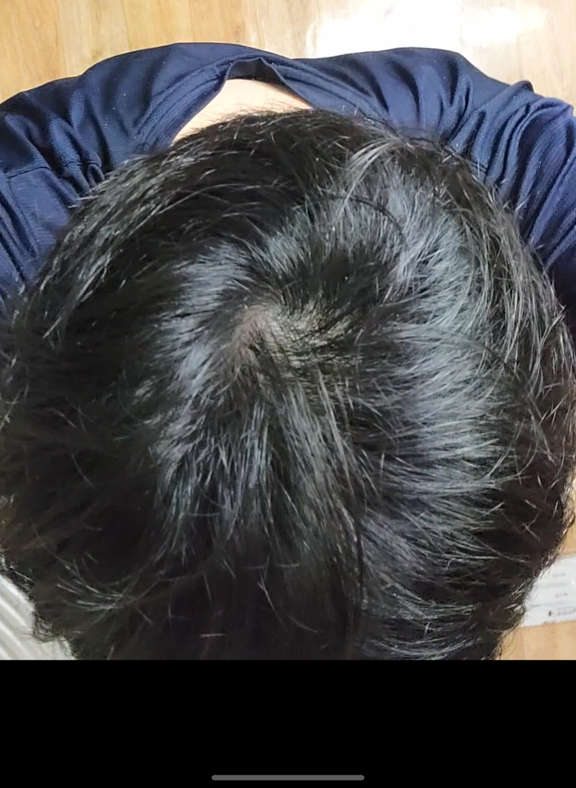오늘찍은 약 70일차 사진입니다. 꽤 채워진거 같아요!