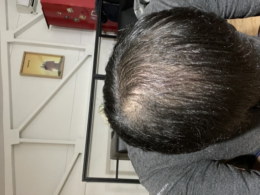 현재 오늘