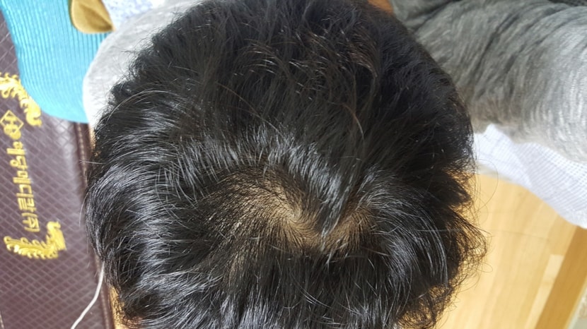 며칠 전 저녁에 씻기 전
