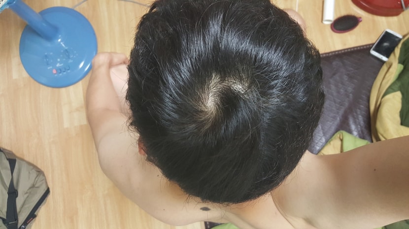 오늘 머리 감은 후 조명 밑