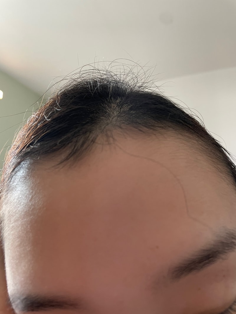 女性 出産 薄毛 1ヶ月 ケア 体験談