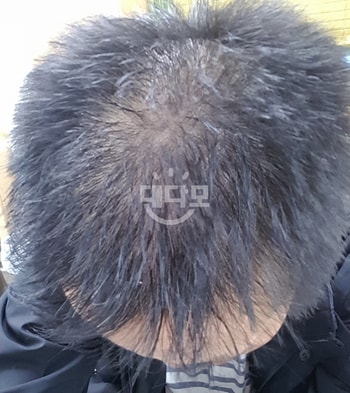 작년11월