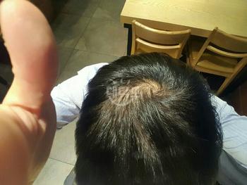 복용 전