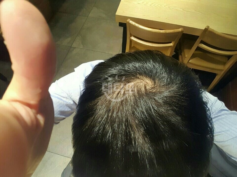복용 전