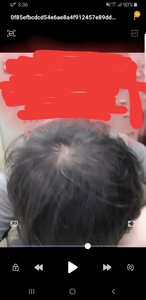 쉐딩인가요 로게인폼, 프로페시아 3주차입니다