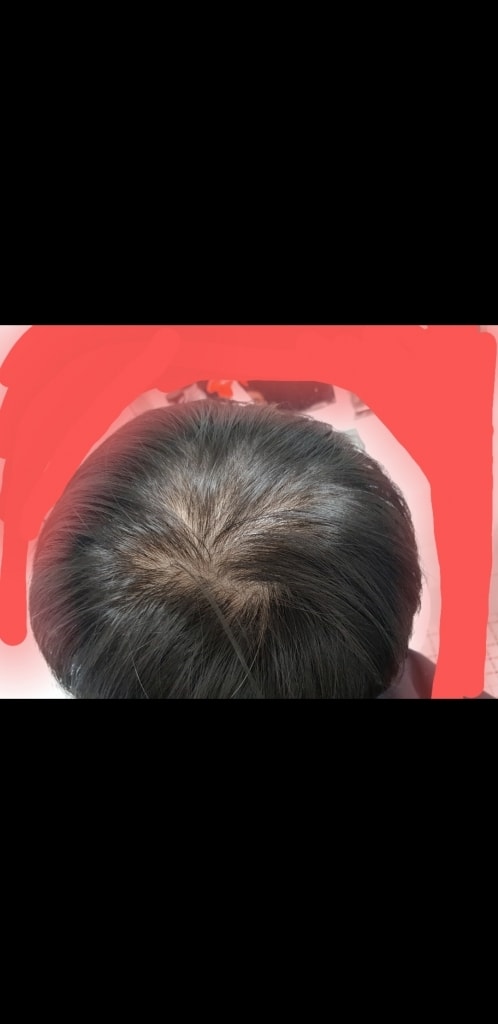 위 현11월 상태