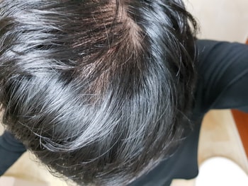 6개월전 마음 아프네요..