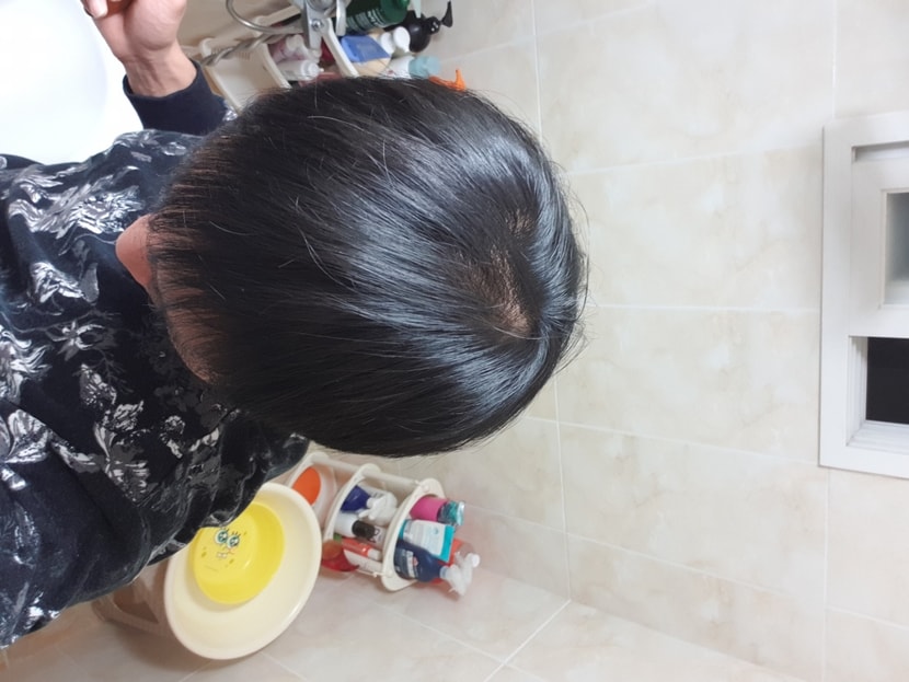 머리카락이 엄청 가늘죠