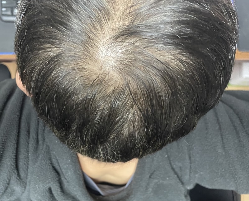 늦었지만 다시 시작합니다