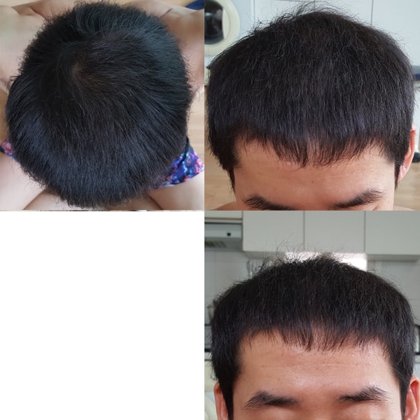 2018년4월말 이발가기전 오후에한컷