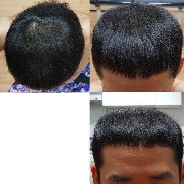 2018년 4월말 이발하고와서 저녁 형광등 밑에서 한컷