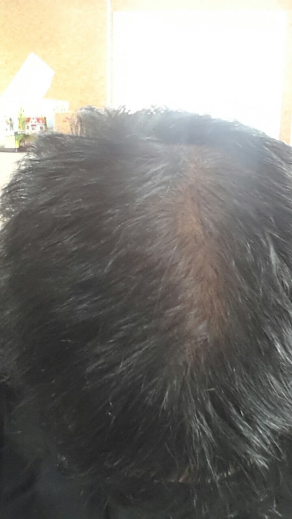 Finfessia1年4个月后期