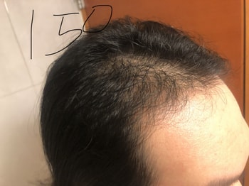 50+