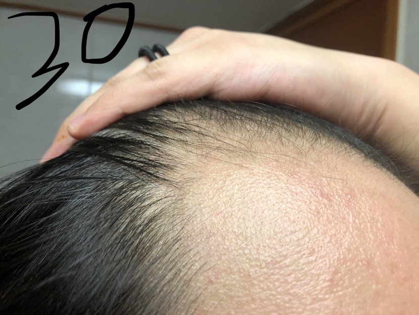 30일차