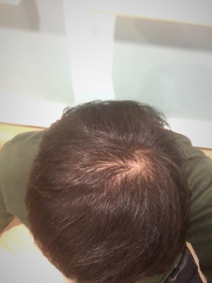 <복용 6개월/현재>