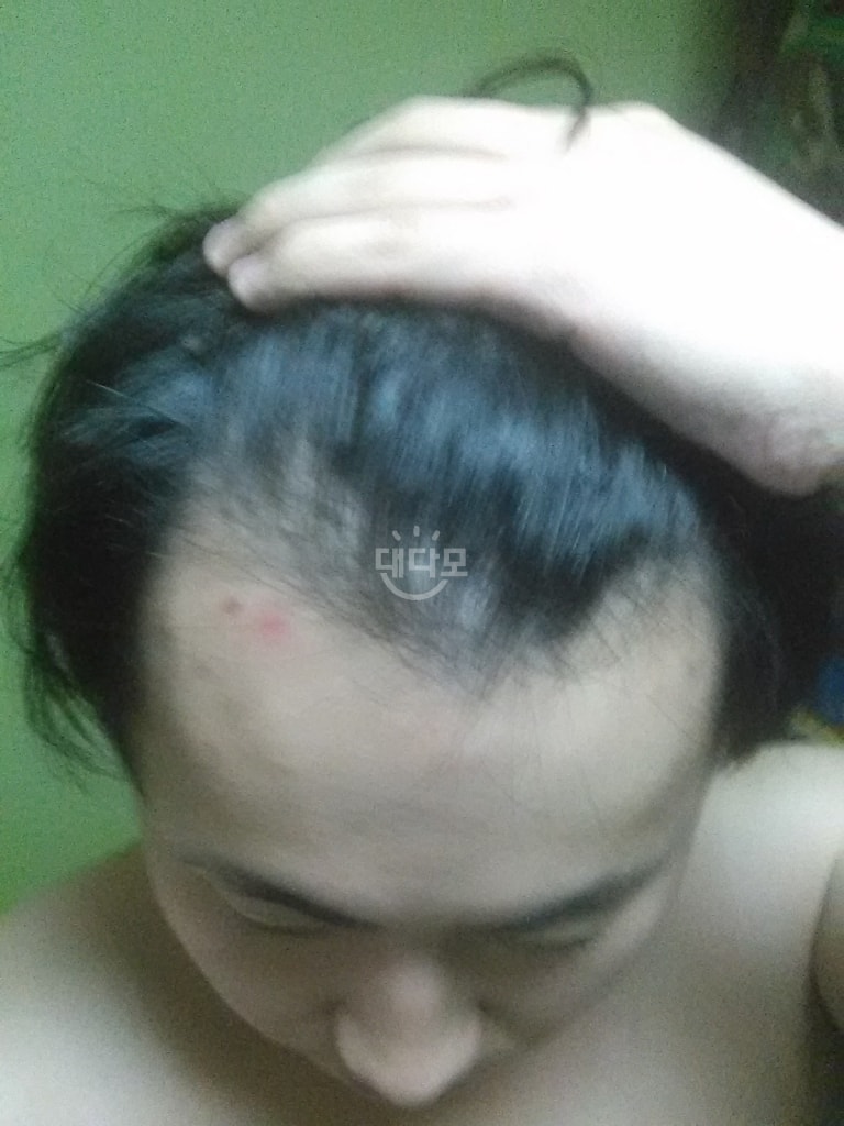 마이시아 3년 경과 후기