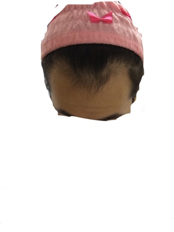 약복용전