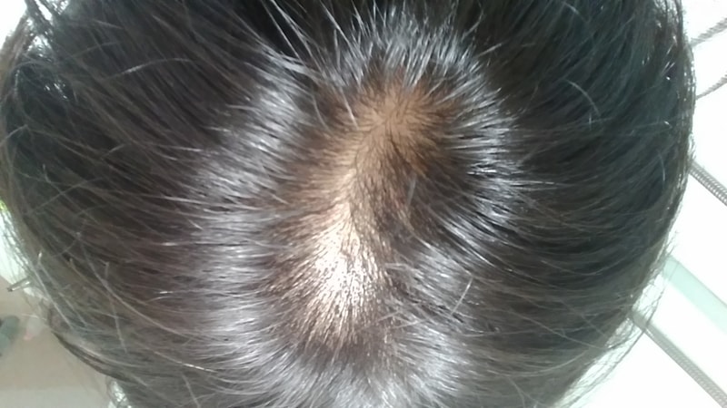 약빨안받는건가요(사진)