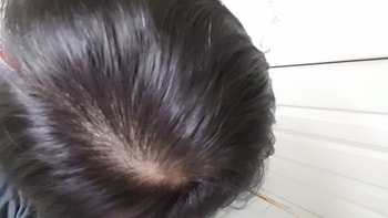 이건 2개월차 다른 사진 