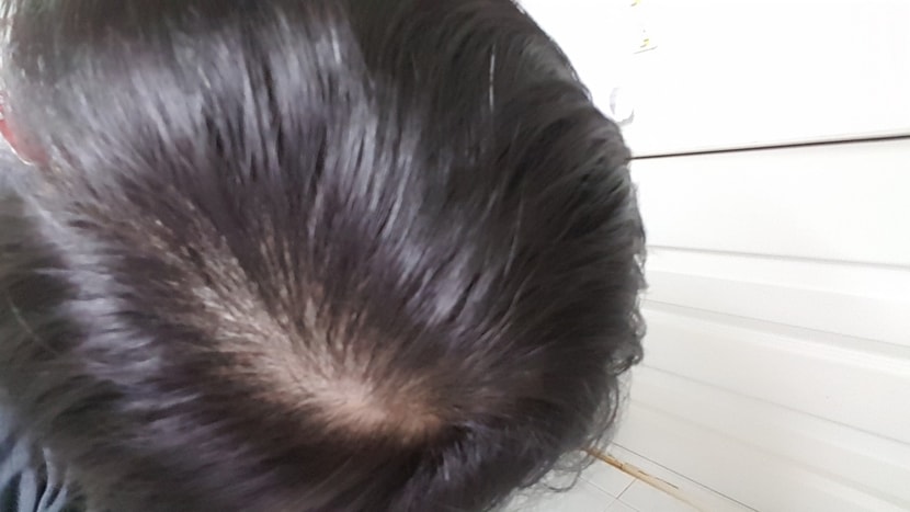 이건 2개월차 다른 사진 