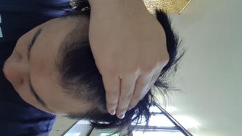 약 처방 받기 전입니다.