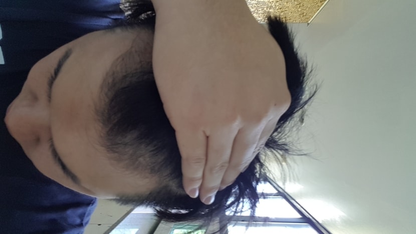 약 처방 받기 전입니다.