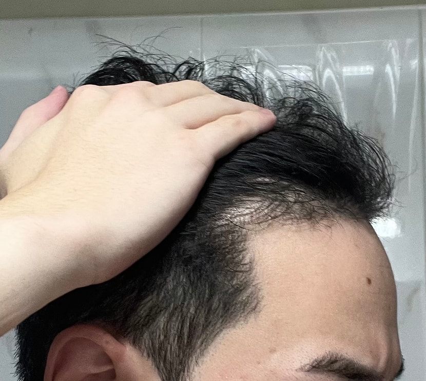 약복용 3개월후