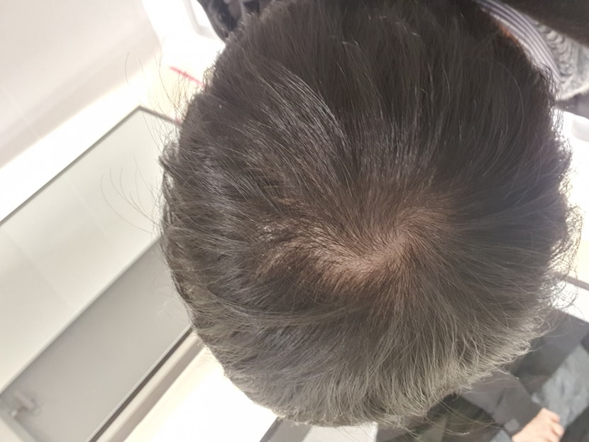 씻고 나왔을때 정상적인모습