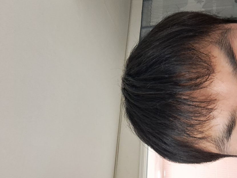 피나 5개월먹은 사진