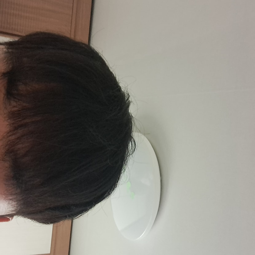 피나 7개월 두타3개월 먹은사진