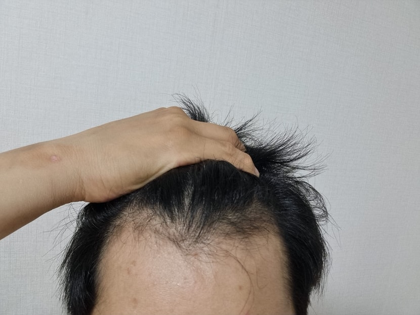 19개월 복용