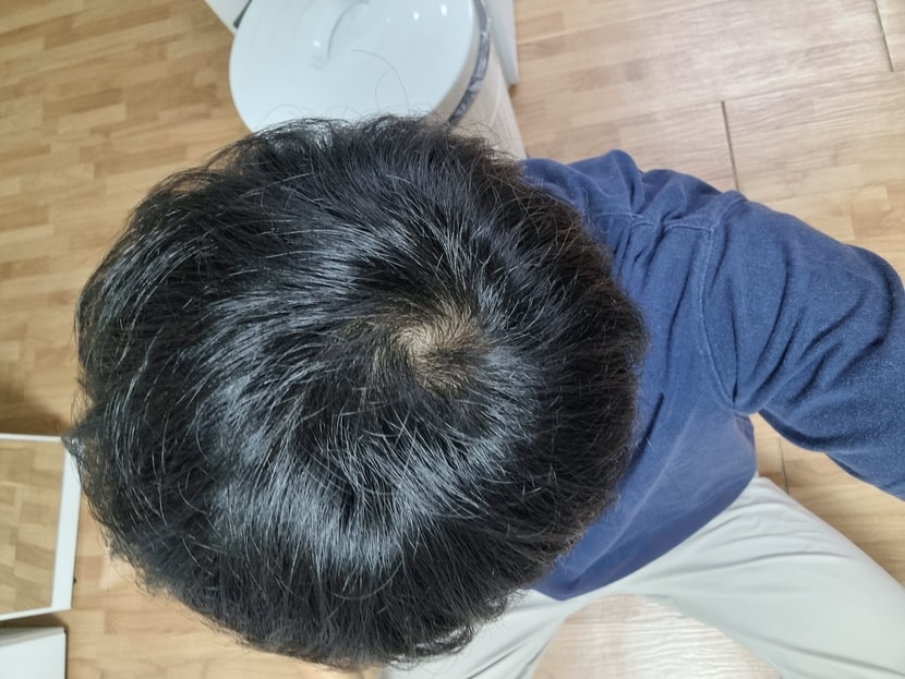 19개월 복용