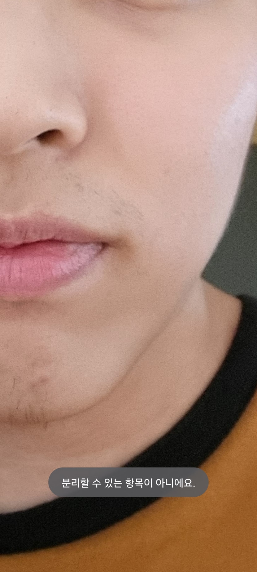 탈모약 복용 전