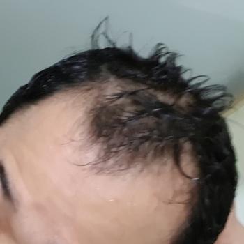 약먹기전 1년전