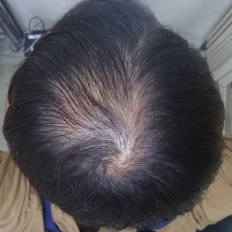 雅培6个月课程中后期