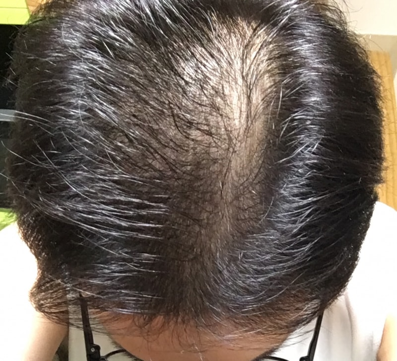 It's been three weeks.