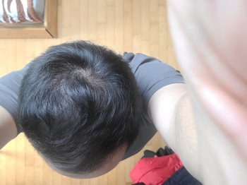 약 복용 10개월차
