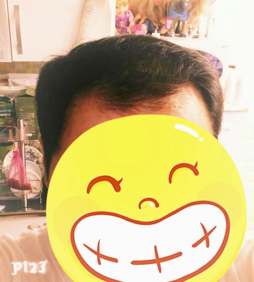 이발하고 9월10일 정면