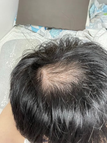 복용전 머리를 감았을때