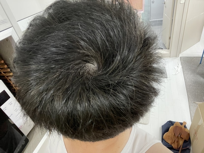 복용 135일