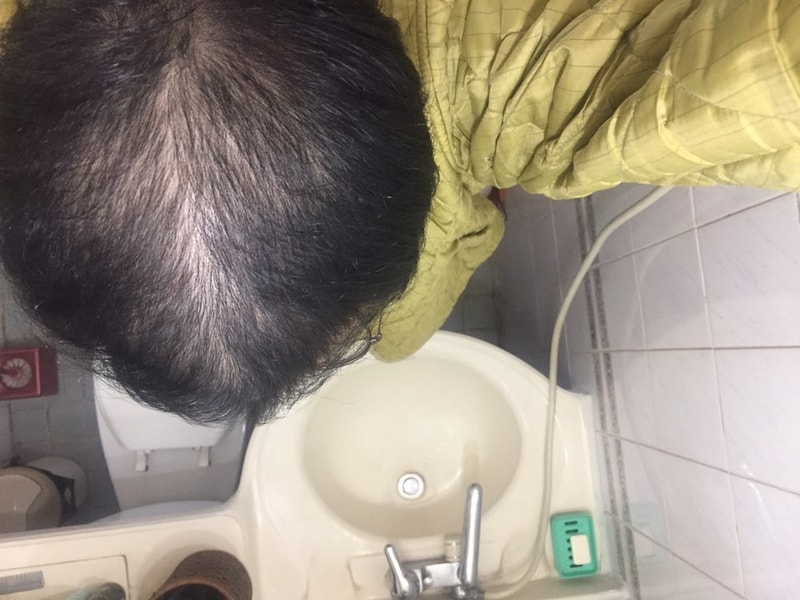 雅培五个月后期