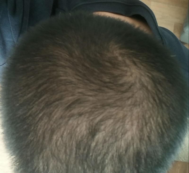 알로펙정 2개월+ 핀카 1/4 1달