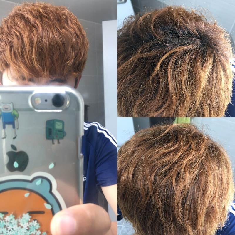 아보+미녹 1년 8개월차 입니다