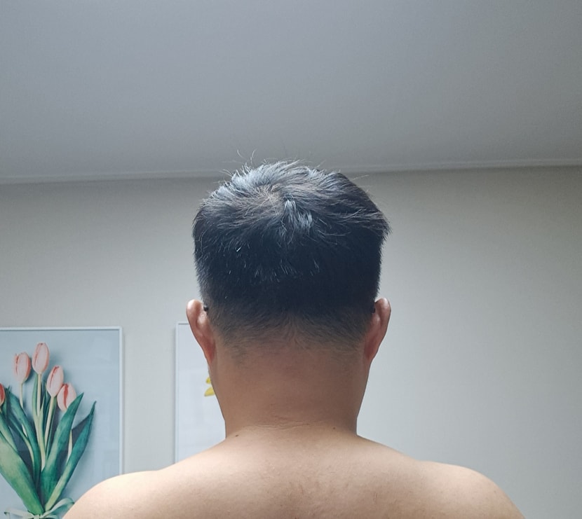 증상
