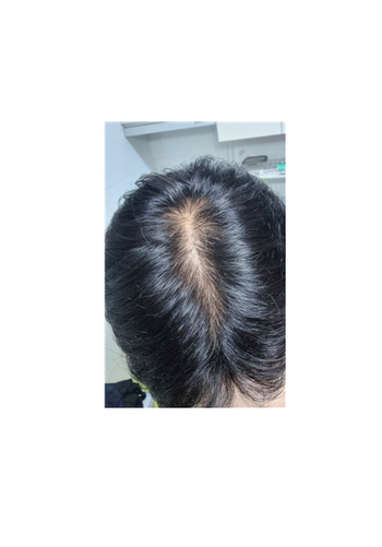 복용 1일차