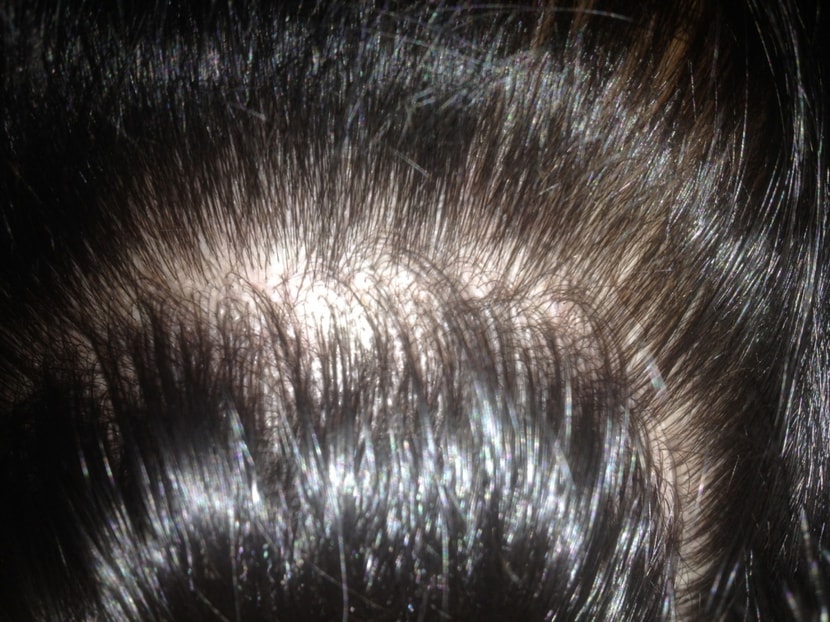 앞쪽머리 들춘것