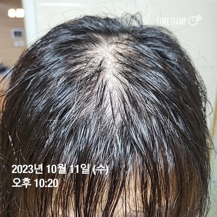 다시 시작