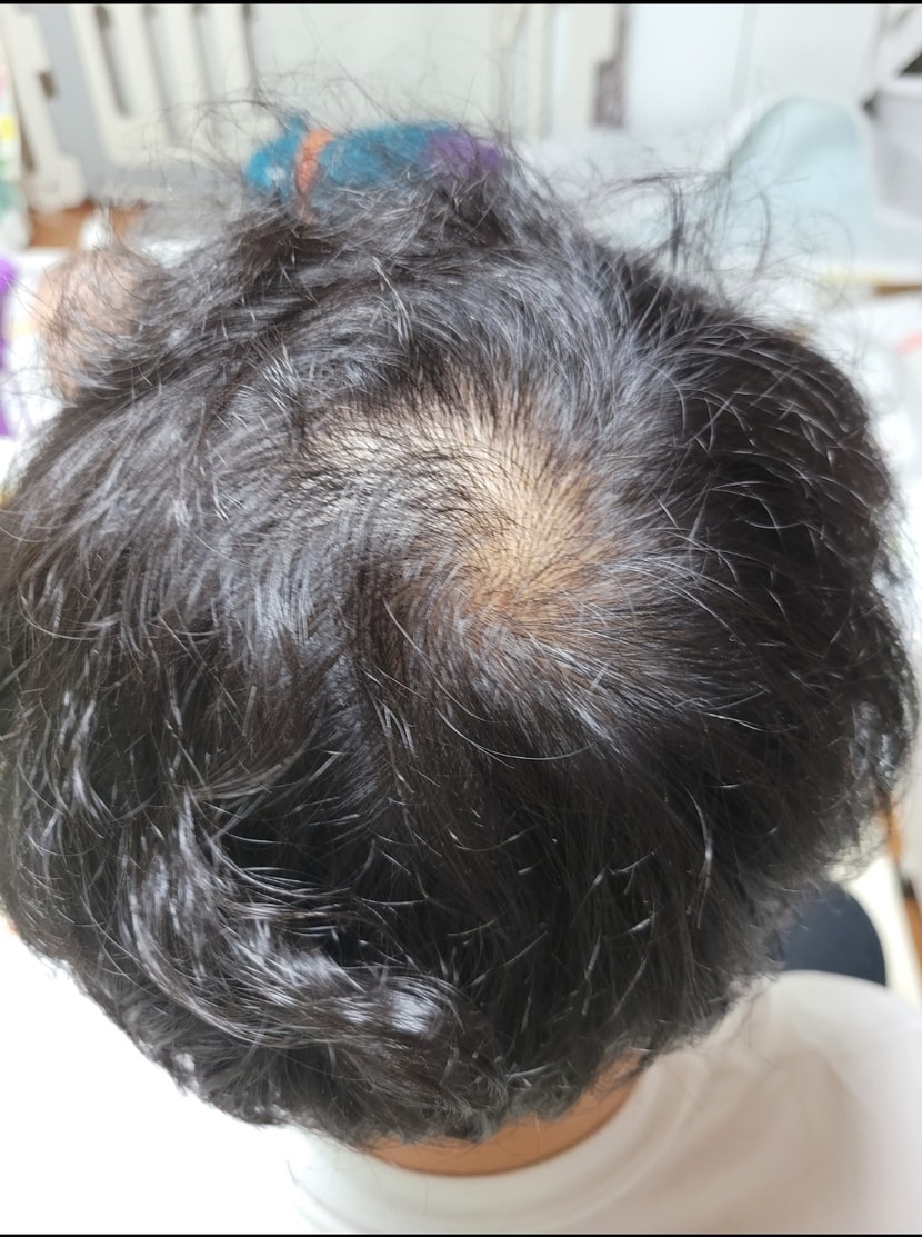 &lt;정수리&gt;